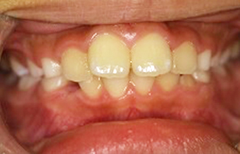 treatment_img_16