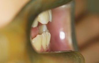 treatment_img_30